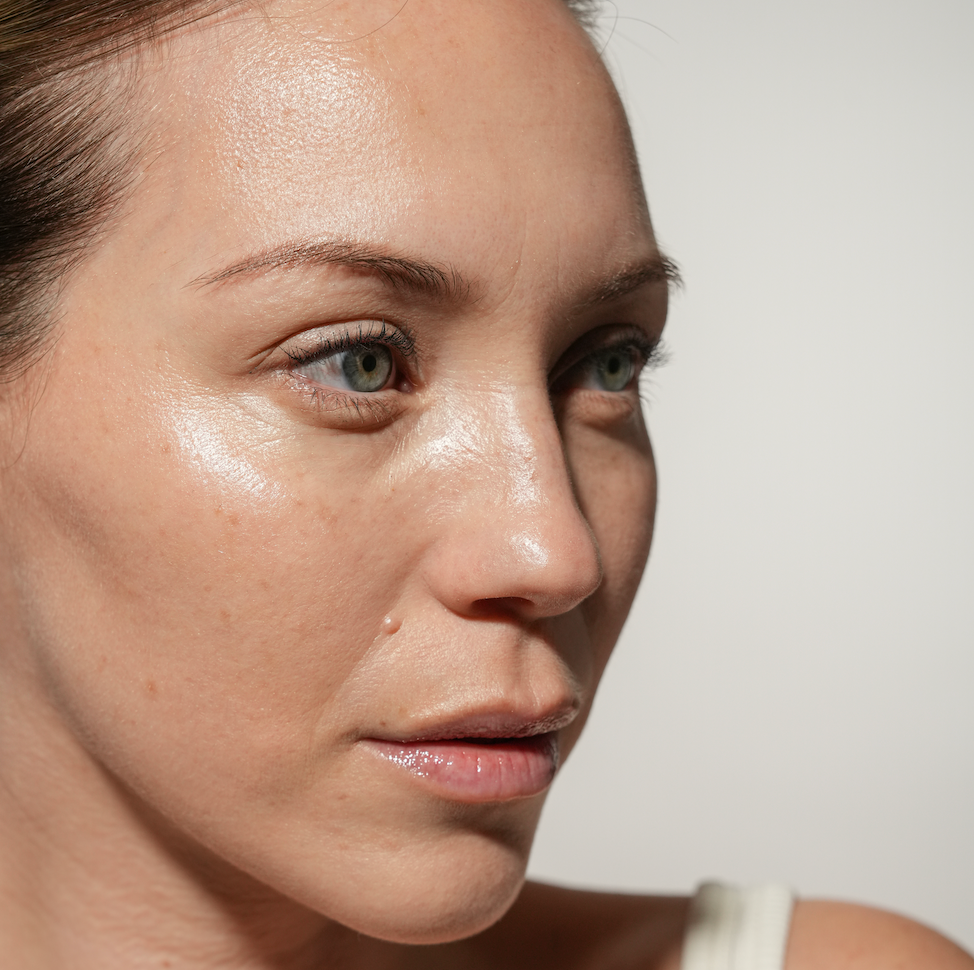 Dites adieu aux imperfections : Les secrets naturels pour une peau éclatante