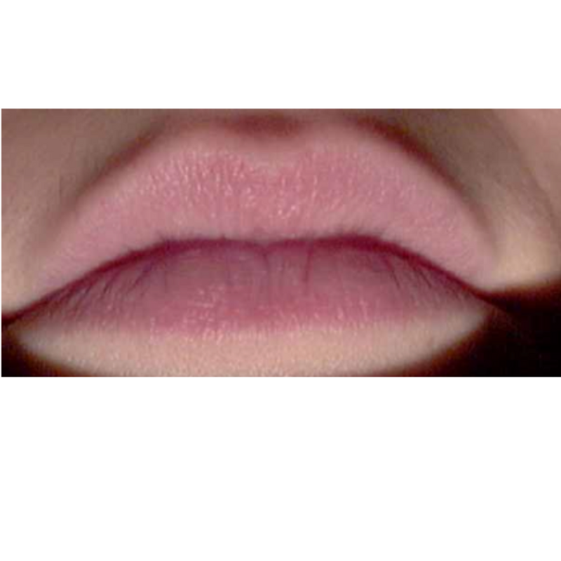 Photo de lèvres après l'utilisation du Sérum Lèvres Repulpant SPF 30 + Peptides pendant 1 mois.