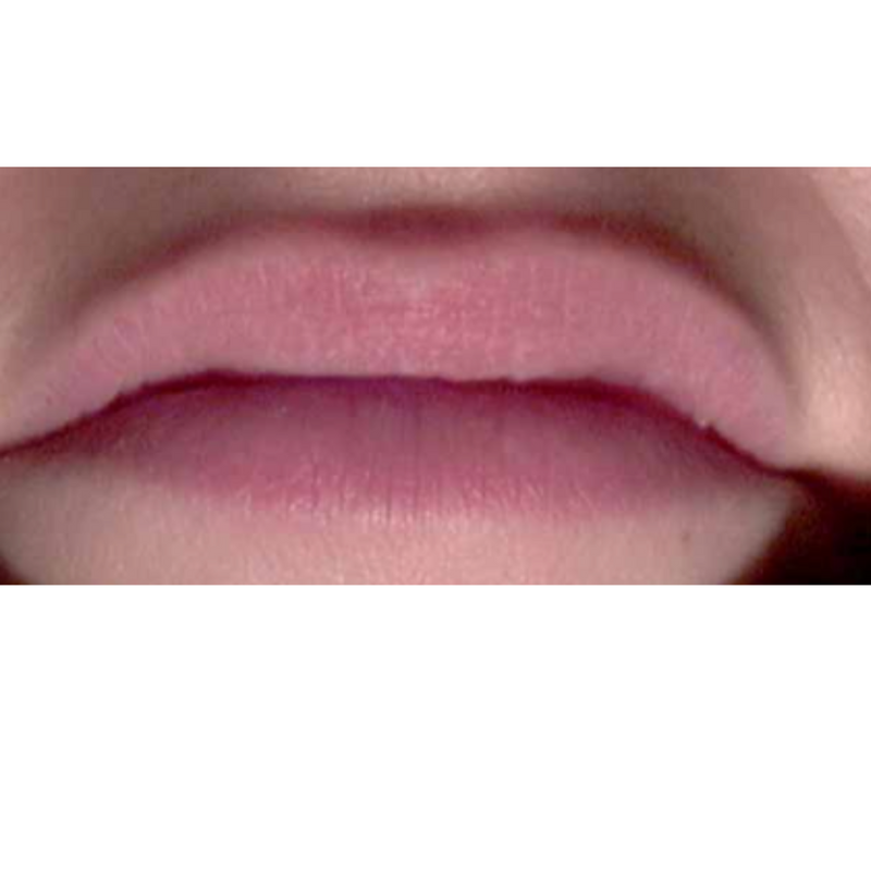 Photo de lèvres avant l'utilisation du Sérum Lèvres Repulpant SPF 30 + Peptides pendant 1 mois.
